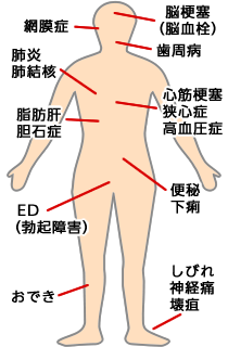 糖尿病による様々な合併症