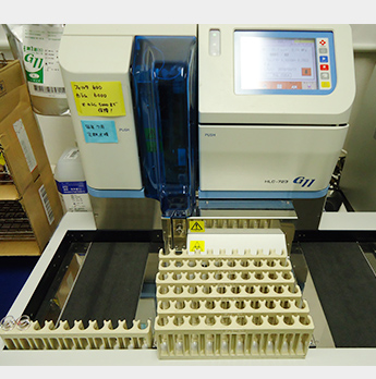 【画像】HbA1c 東ソー G11