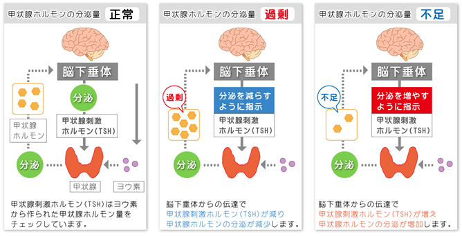 甲状腺 ホルモン 低下